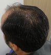 Pre-op 10-3.jpg