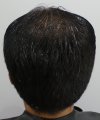 Pre-op 10-4.jpg
