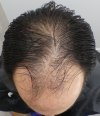 Pre-op 11.jpg