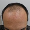 Pre-op 12-1.jpg