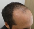 Pre-op 12-3.jpg