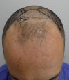pre-op 13.jpg