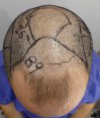Pre-op 13-2.jpg