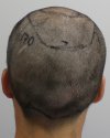 Pre-op 13-5.jpg