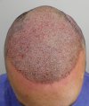 Post-op 1-10.jpg