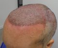 Post-op 1-5.jpg