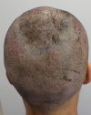 Post-op 1-6.jpg