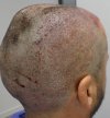 Post-op 1-9.jpg