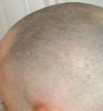 P_20160302_083140_1_p_1.jpg