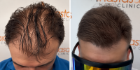 Before and After Hair Transformation (1).png
