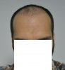 2 months 4.JPG