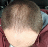 head.GIF
