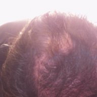 hairybeast